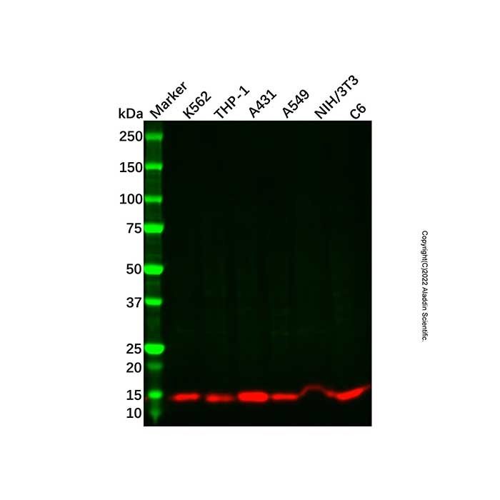 Recombinant Cystatin A Antibody -    by Aladdin Scientific