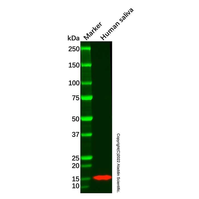 Cystatin SN/CST1 Mouse mAb -    by Aladdin Scientific