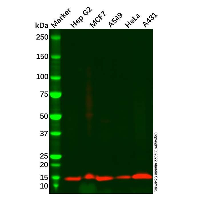 Cystatin-B Antibody - by Aladdin Scientific