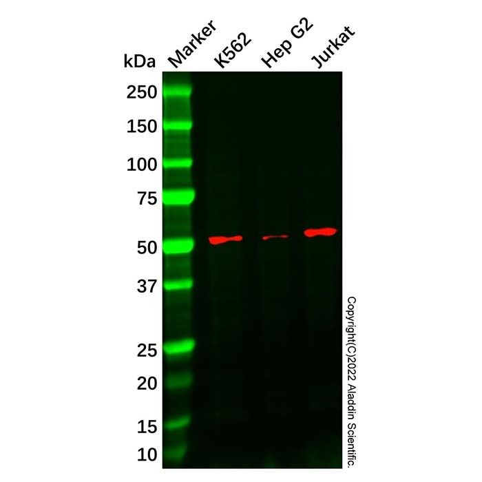 Recombinant Cytochrome P450 17A1/CYP17A1 Antibody -    by Aladdin Scientific