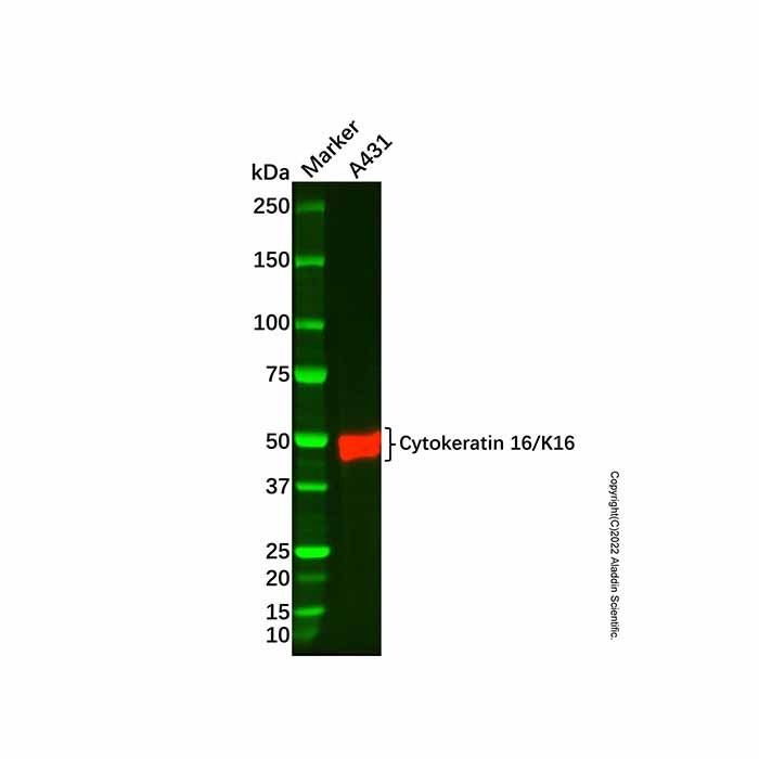 Recombinant Cytokeratin 16/K16 Antibody -    by Aladdin Scientific