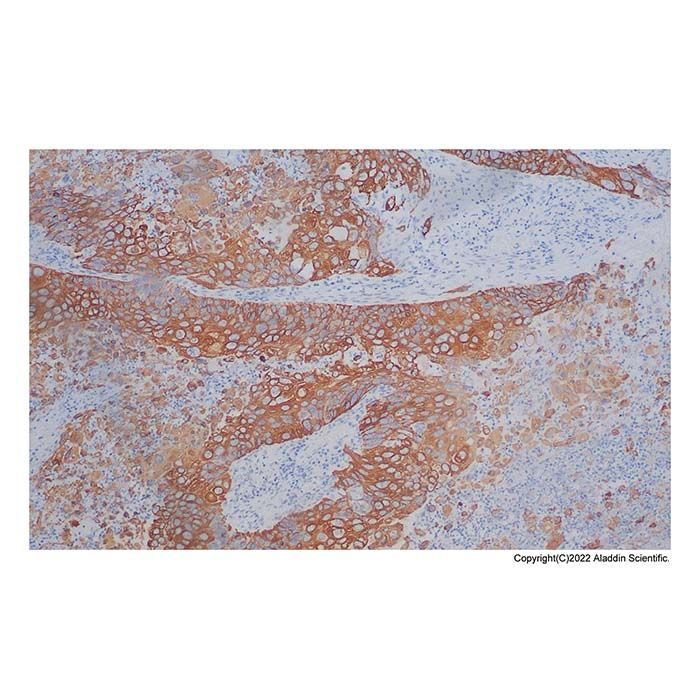 Recombinant Cytokeratin 5 + 6 Antibody -    by Aladdin Scientific
