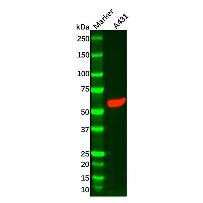 Recombinant Cytokeratin 5 Antibody -    by Aladdin Scientific