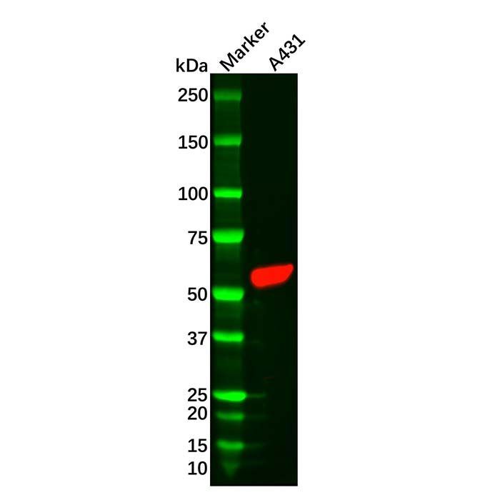 Recombinant Cytokeratin 6 Antibody -    by Aladdin Scientific