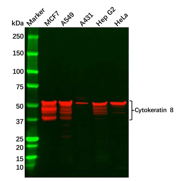Cytokeratin 8 Antibody -    by Aladdin Scientific