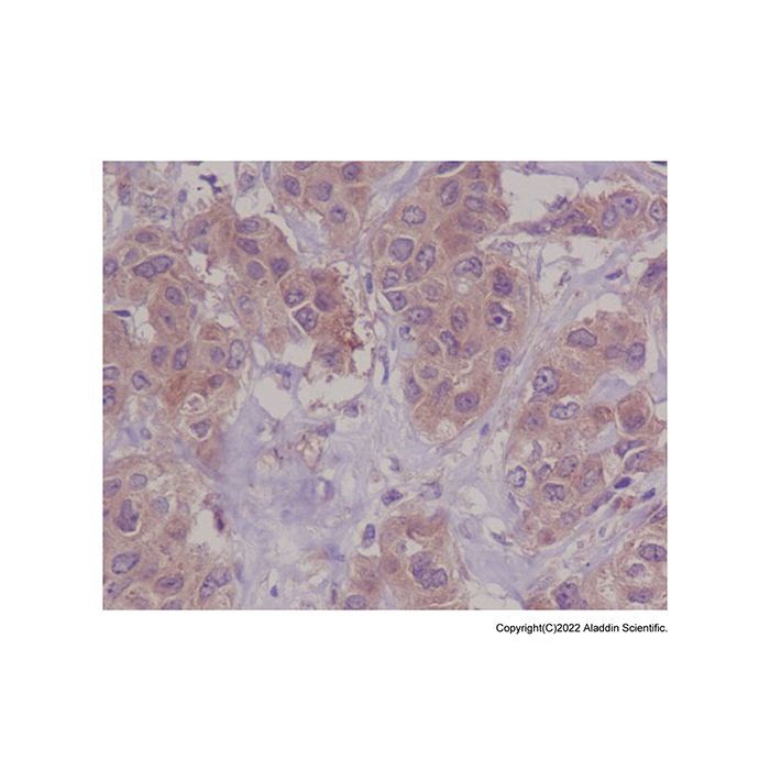 Recombinant DAP Kinase 1 Antibody -    by Aladdin Scientific