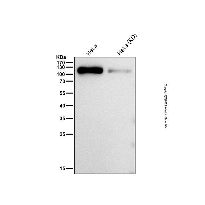 Recombinant Daxx Antibody -    by Aladdin Scientific