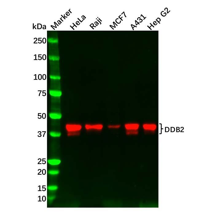 Recombinant DDB2 Antibody -    by Aladdin Scientific
