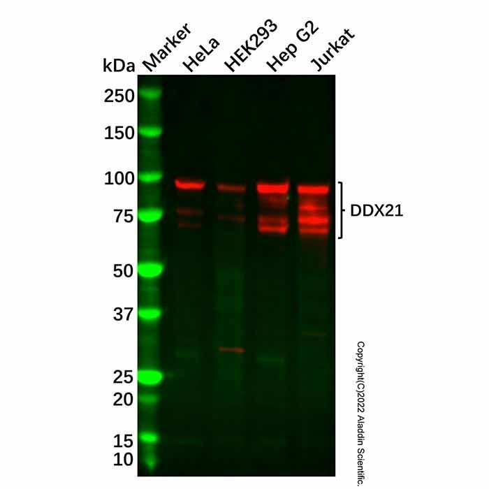 Recombinant DDX21 Antibody -    by Aladdin Scientific