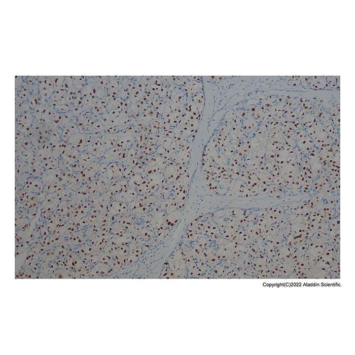 Recombinant delta 1 Catenin/CAS Antibody -    by Aladdin Scientific