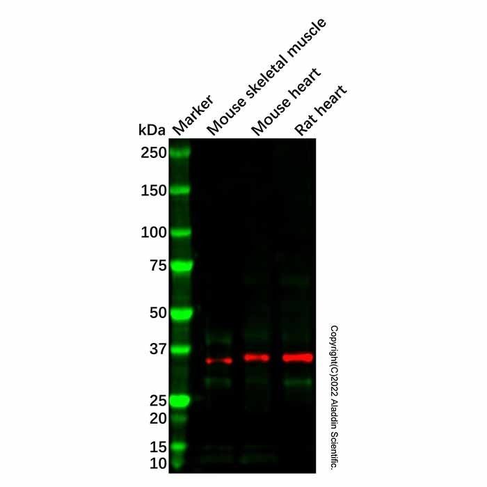 Recombinant delta Sarcoglycan Antibody -    by Aladdin Scientific