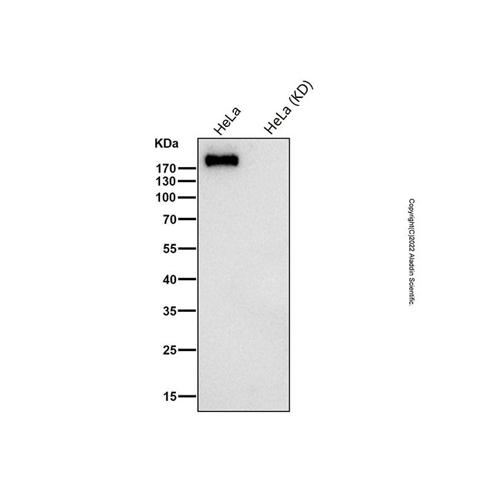 Recombinant DENN Antibody -    by Aladdin Scientific