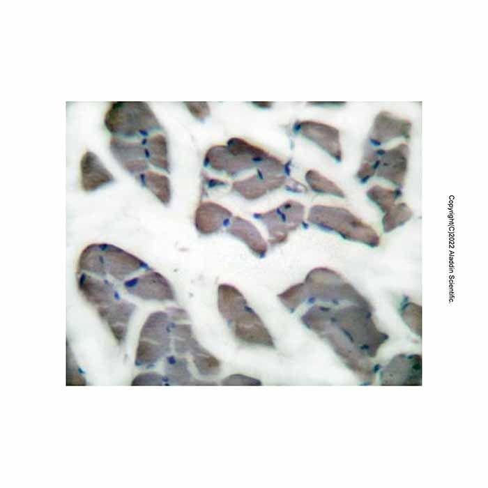 Desmin Antibody -    by Aladdin Scientific