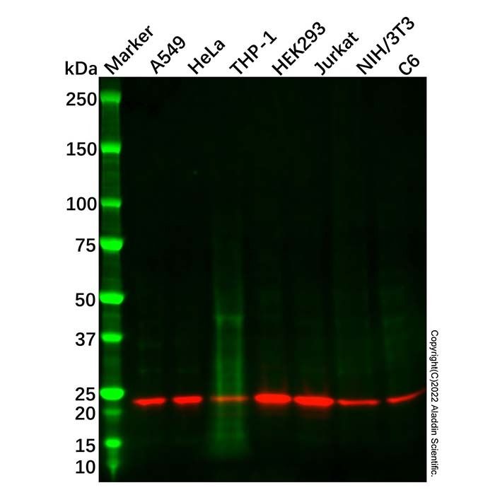 Recombinant Dihydrofolate reductase/DHFR Antibody -    by Aladdin Scientific