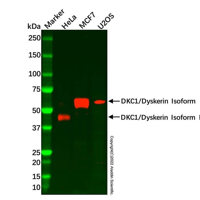 Recombinant DKC1/Dyskerin Antibody -    by Aladdin Scientific