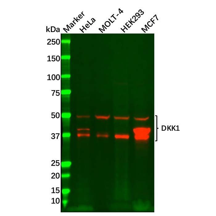 Recombinant DKK1 Antibody -    by Aladdin Scientific