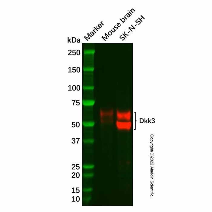Recombinant Dkk3 Antibody -    by Aladdin Scientific