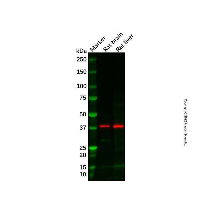 Recombinant DNA Polymerase beta Antibody -    by Aladdin Scientific