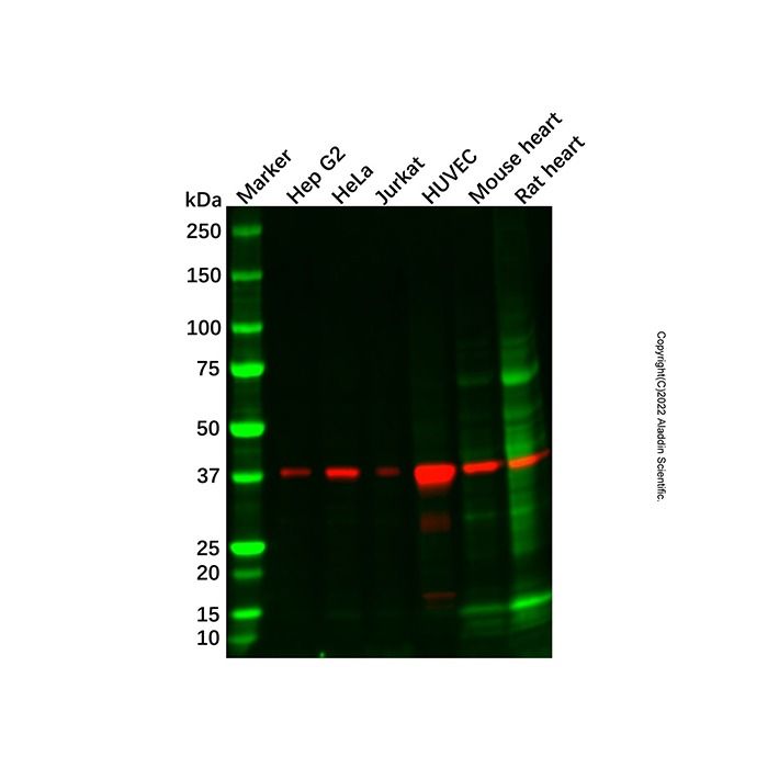 DNAJB4 Mouse mAb -    by Aladdin Scientific