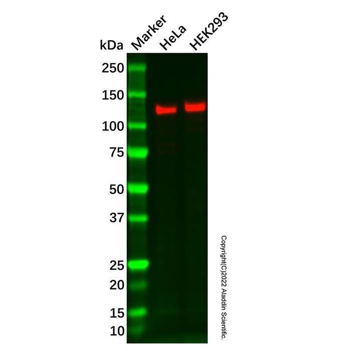 Recombinant Dnmt3a Antibody -    by Aladdin Scientific