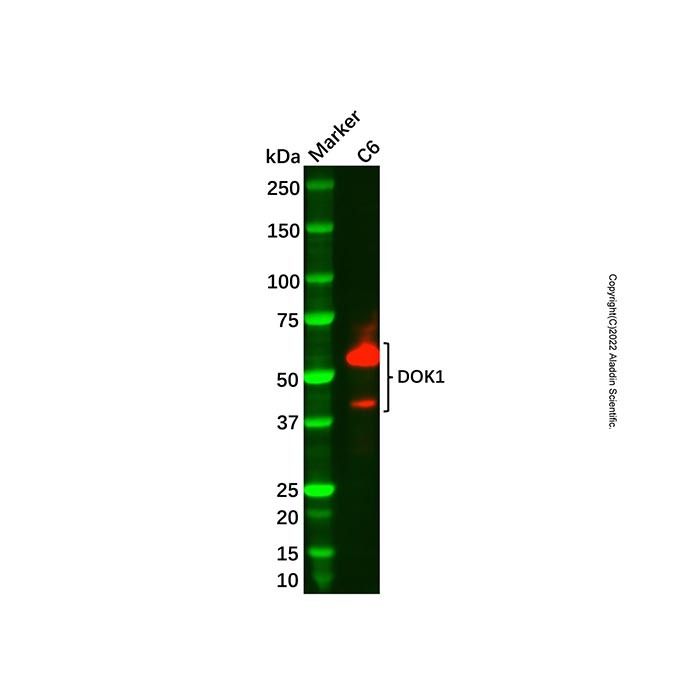 Recombinant DOK1 Antibody -    by Aladdin Scientific