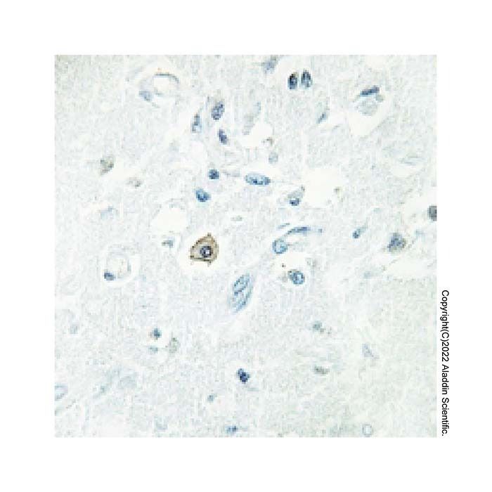DOK7 Antibody -    by Aladdin Scientific