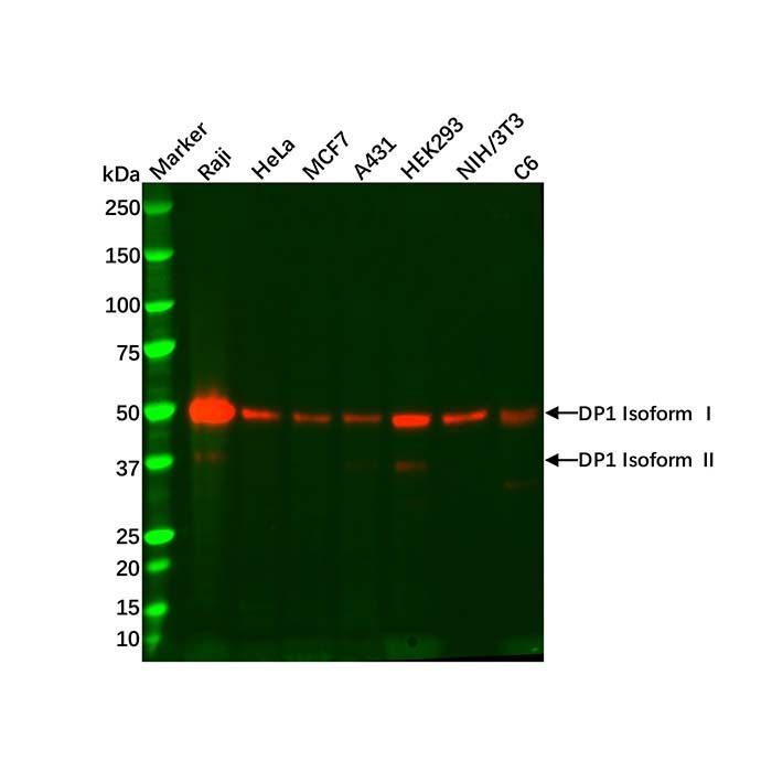Recombinant DP1 Antibody -    by Aladdin Scientific
