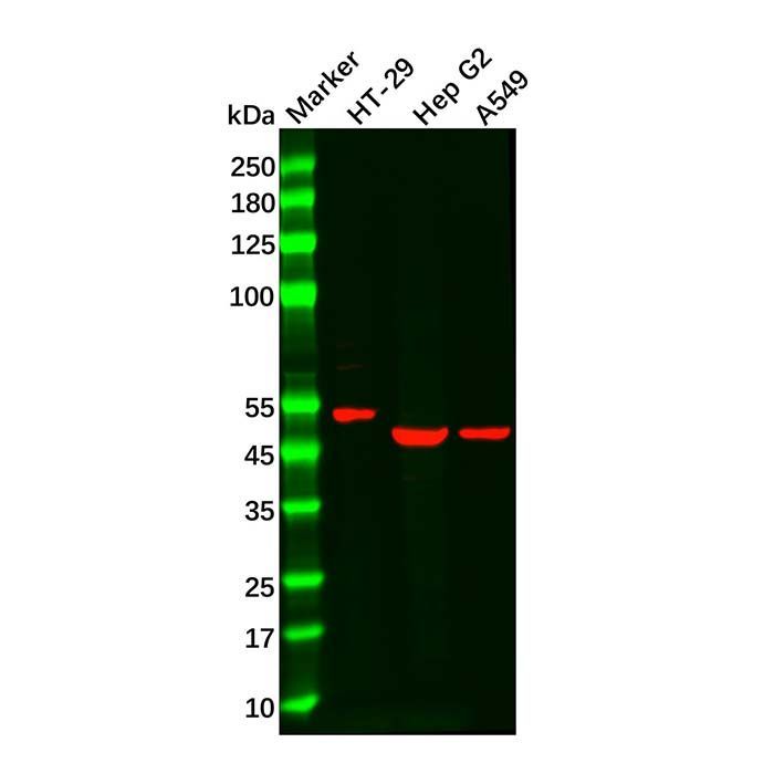Recombinant DR5 Antibody -    by Aladdin Scientific