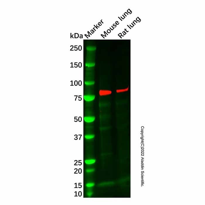 Recombinant Dynein intermediate chain 1/DNAI1 Antibody -    by Aladdin Scientific