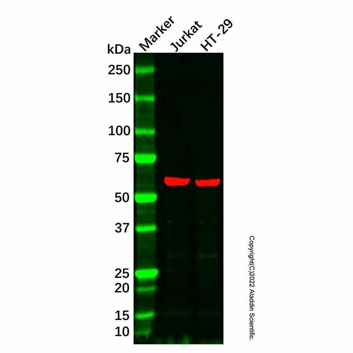 Dystrophia myotonica protein kinase/DMPK Antibody -    by Aladdin Scientific