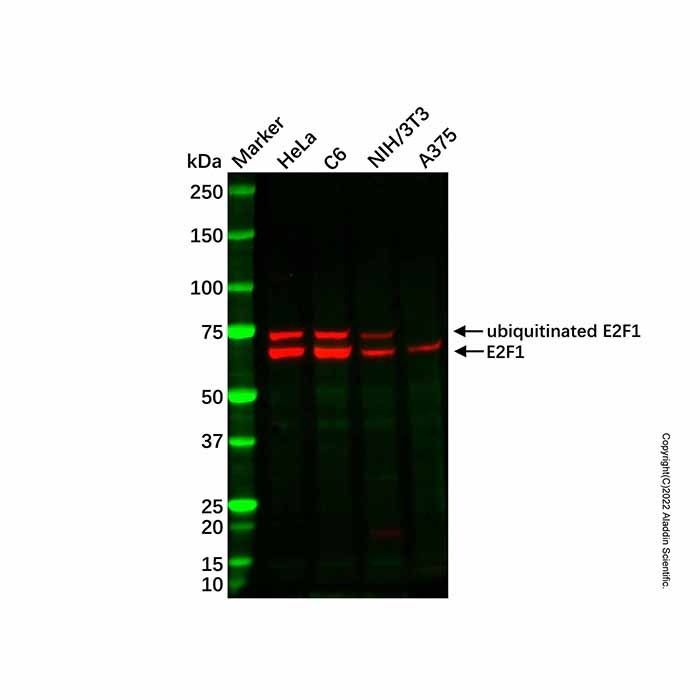 Recombinant E2F1 Antibody -    by Aladdin Scientific