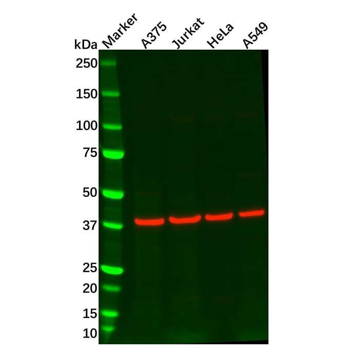 Recombinant EDG2/LPA-1 Antibody -    by Aladdin Scientific