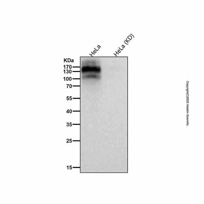Recombinant EHMT2/G9A Antibody -    by Aladdin Scientific
