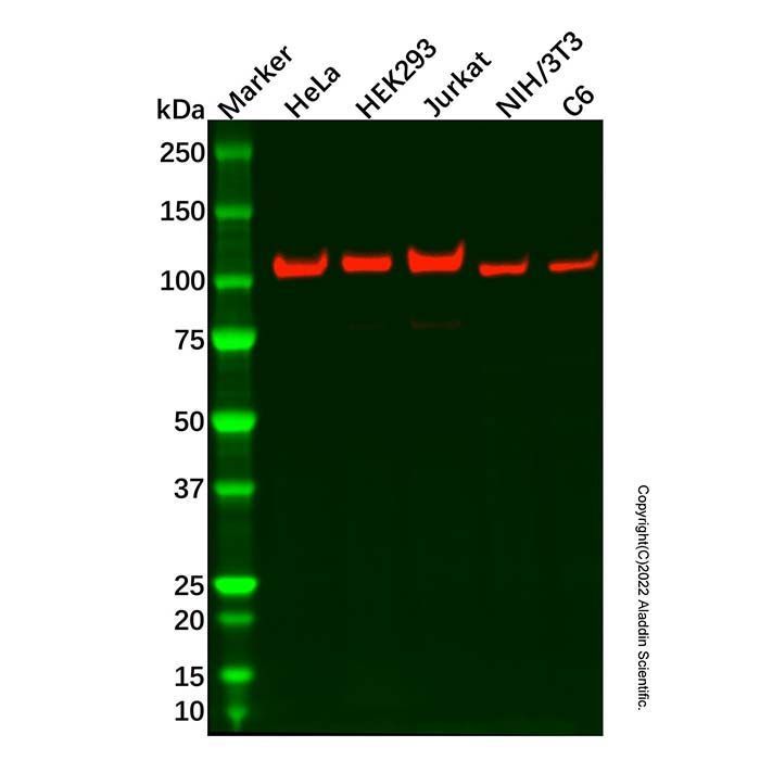 Recombinant eIF3B Antibody -    by Aladdin Scientific