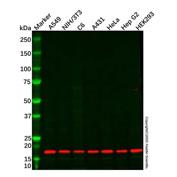 eIF5A2 Antibody -    by Aladdin Scientific