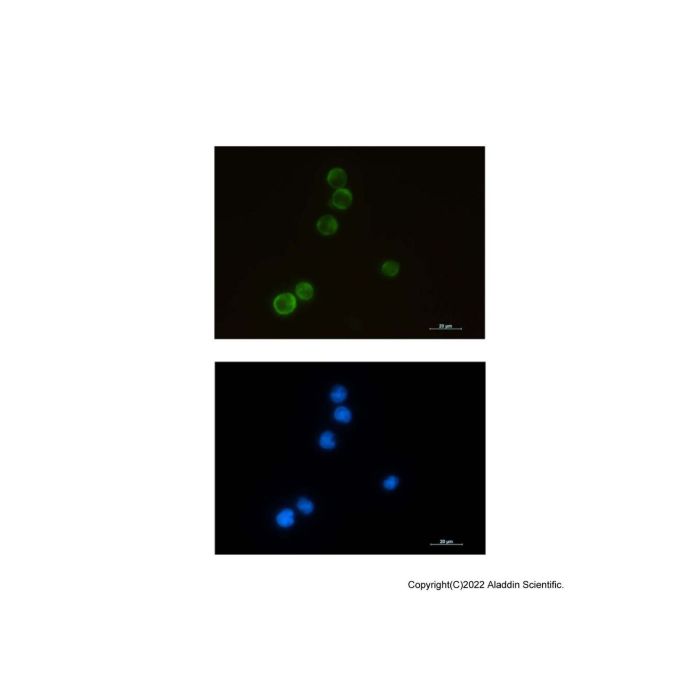 Recombinant ELMO1 Antibody -    by Aladdin Scientific