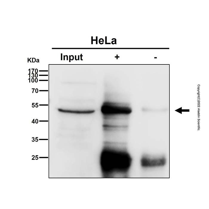 Recombinant Elongation factor 1-gamma Antibody -    by Aladdin Scientific