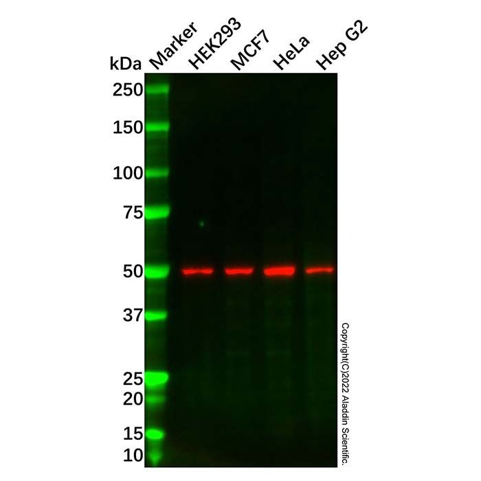 Recombinant ENPP5 Antibody -    by Aladdin Scientific