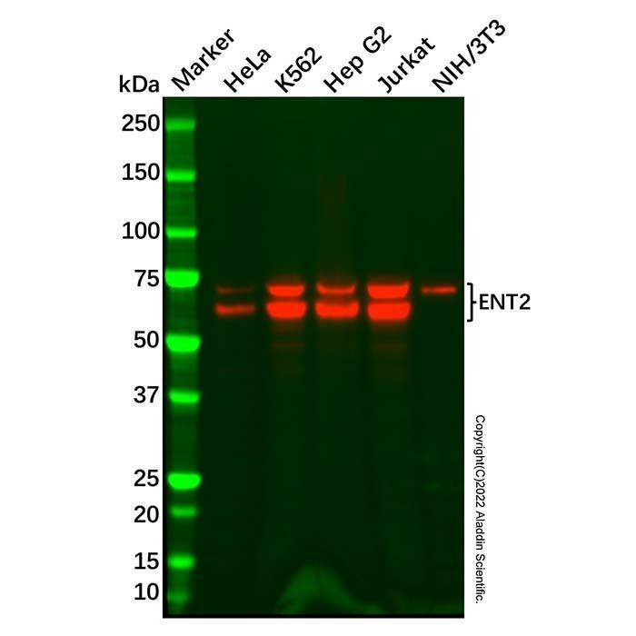 Recombinant ENT2 Antibody - by Aladdin Scientific
