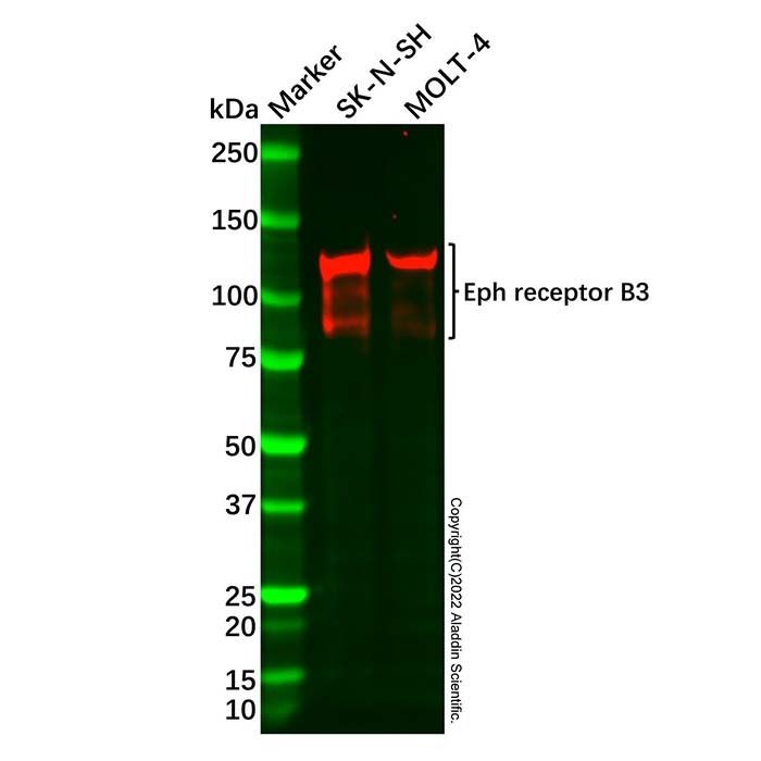 Recombinant Eph receptor B3 Antibody -    by Aladdin Scientific