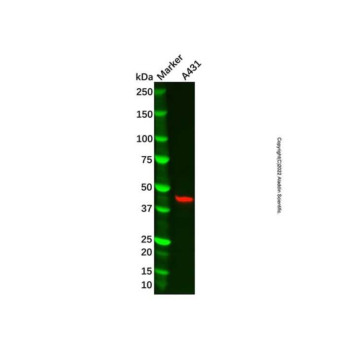 Recombinant ESE1 Antibody -    by Aladdin Scientific