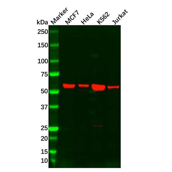 Estrogen Receptor beta Antibody -    by Aladdin Scientific