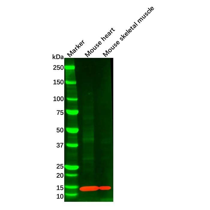 FABP4 Mouse mAb -    by Aladdin Scientific