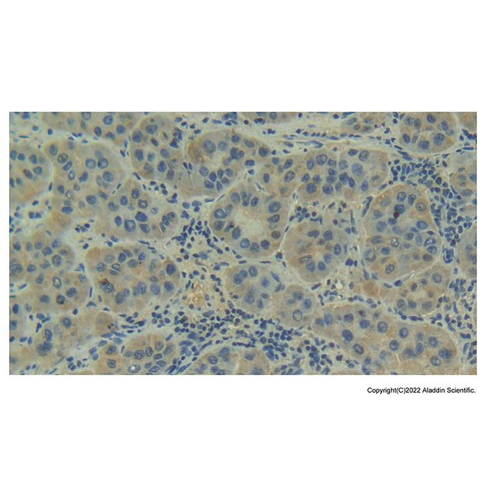 Factor B Antibody -    by Aladdin Scientific