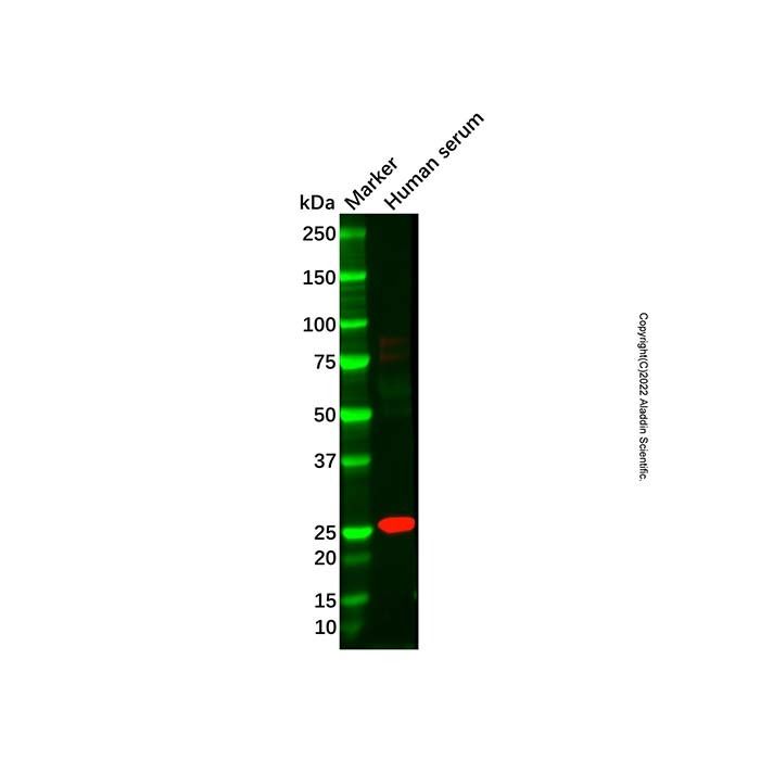 Recombinant Factor D/CFD Antibody -    by Aladdin Scientific