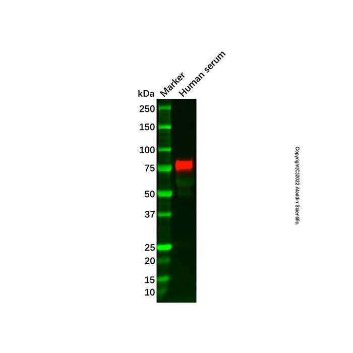 Recombinant Factor XIIIa Antibody -    by Aladdin Scientific