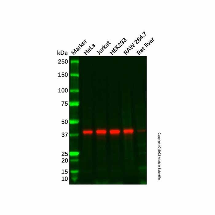 Recombinant FAM50A/XAP5 Antibody -    by Aladdin Scientific