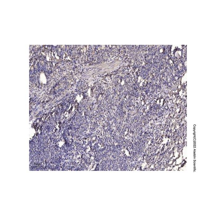 FAM84B Antibody -    by Aladdin Scientific