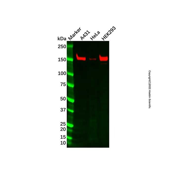 Recombinant FANCA/FAA Antibody -    by Aladdin Scientific