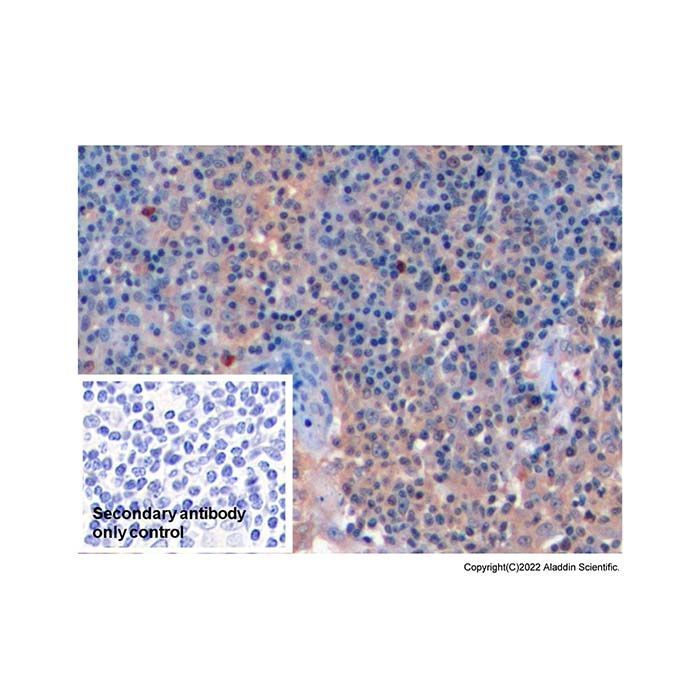 Fas Antibody -    by Aladdin Scientific